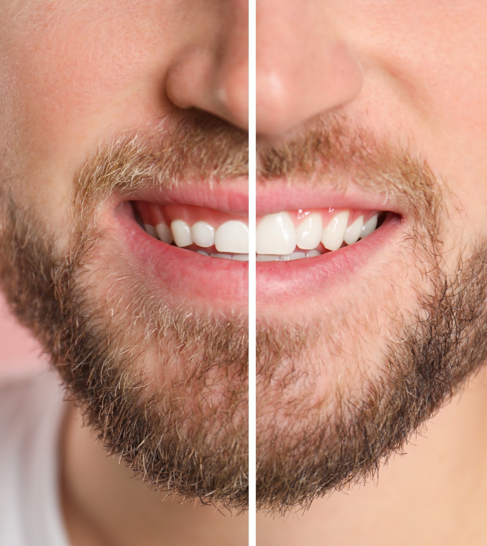 Young man with healthy teeth on color background, closeup. Space for text